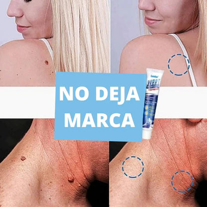 Wart Remover - Renovedor de verrugas D T